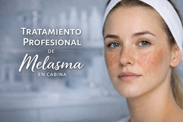 protocolo melasma tratamiento despigmentante facial profesional