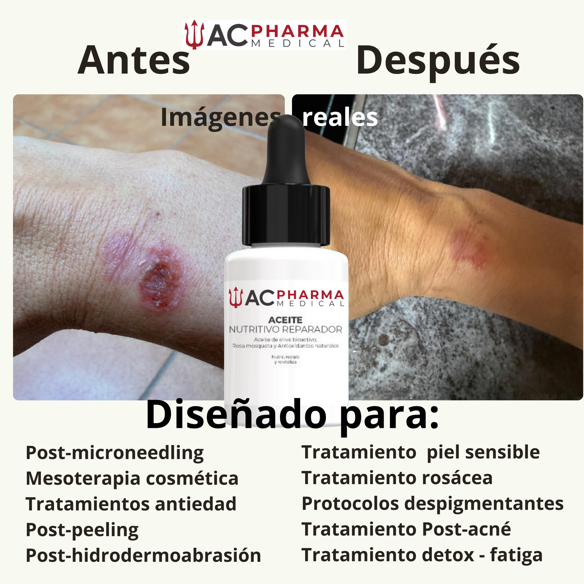 comparativa antes y despues aceite nutritivo reparador acpharma medical